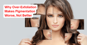 Why Over-Exfoliation Makes Pigmentation Worse, Not Better