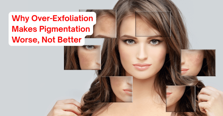 Why Over-Exfoliation Makes Pigmentation Worse, Not Better